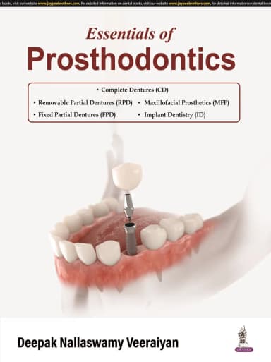 Image of - Essentials of Prosthodontics