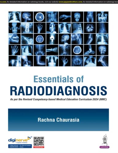 Image of - Essentials of Radiodiagnosis