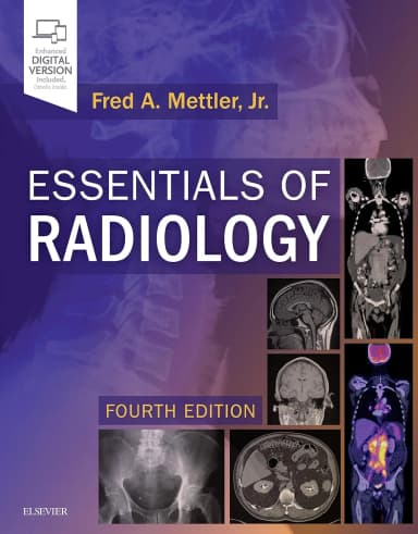 Image of - Essentials of Radiology - 4E