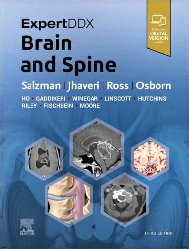 Image of - ExpertDDx: Brain and Spine - 3E