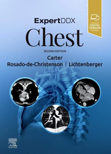 Image of - ExpertDDx: Chest-2E