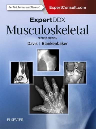 Image of - ExpertDDx: Musculoskeletal - 2E