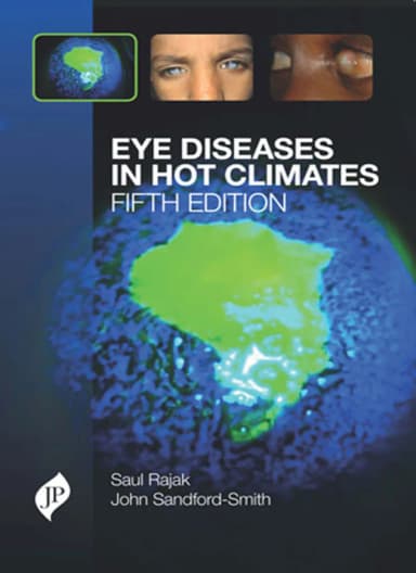 Image of - Eye Diseases in Hot Climates