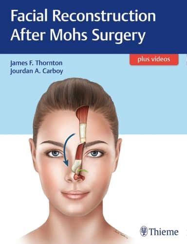 Image of - Facial Reconstruction After Mohs Surgery 1st Ed.