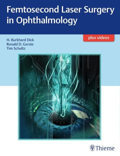 Image of - Femtosecond Laser Surgery in Ophthalmology 1st Ed.