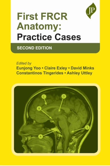 Image of - First FRCR Anatomy | Practice Cases