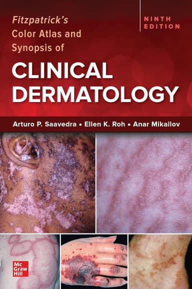 Image of - Fitzpatrick's Color Atlas and Synopsis of Clinical Dermatology (IE) - 9E