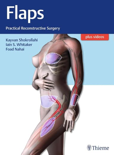 Image of - Flaps: Practical Reconstructive Surgery: 1/e