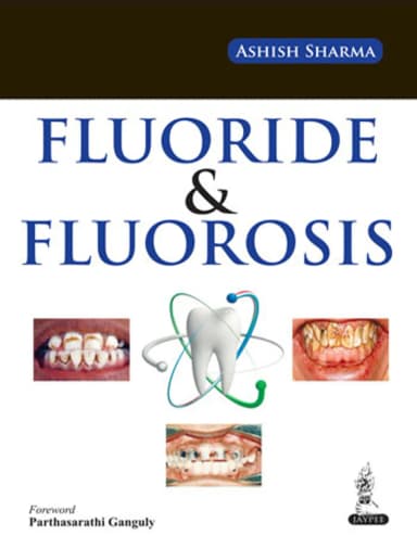 Image of - Fluoride and Fluorosis (A Research Review)