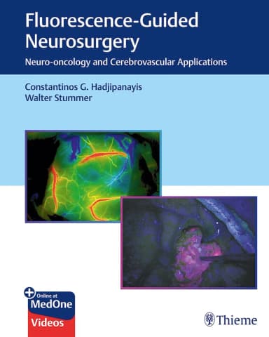 Image of - Flurescence - Guided Neurosurgery 1st Ed.