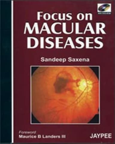 Image of - Focus on Macular Diseases (with DVD-ROM)