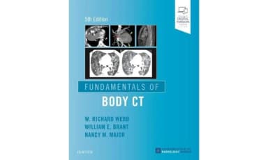 Image of - Fundamentals of Body CT - 5E