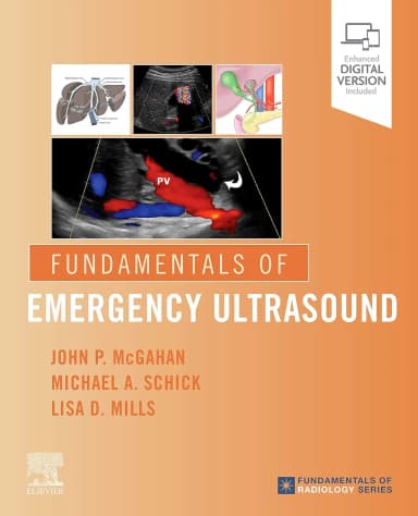 Image of - Fundamentals of Emergency Ultrasound - 1E