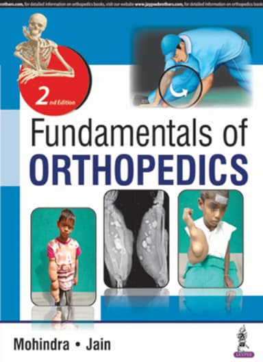 Image of - Fundamentals of Orthopedics