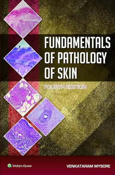 Image of - Fundamentals of Pathology of Skin - 4E