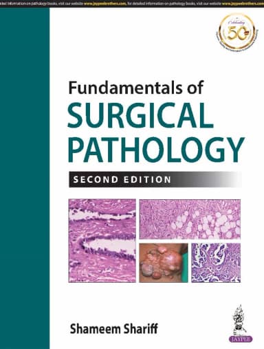 Image of - Fundamentals of Surgical Pathology