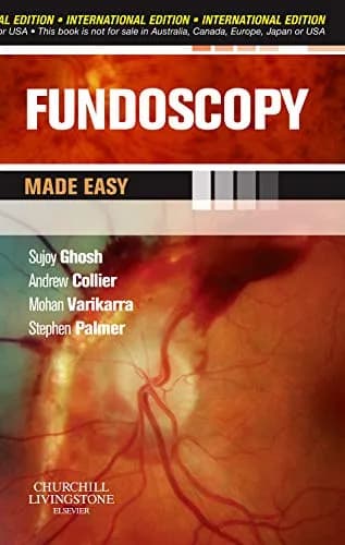 Image of - Fundoscopy Made Easy - 1st Edition