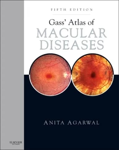 Image of - Stereoscopic Atlas/Macular Dis 5/e (2vol)
