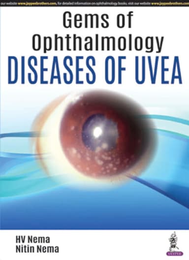 Image of - Gems of OphthalmologyâDiseases of Uvea