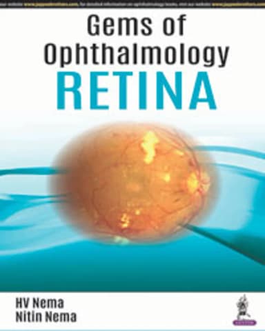 Image of - Gems of OphthalmologyâRetina