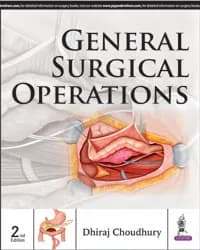 Image of - GENERAL SURGICAL OPERATIONS