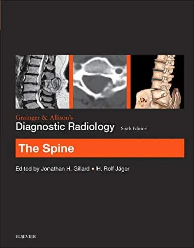 Image of - Grainger and Allisons Diagnostic Radiology The Spine - 6th Edition