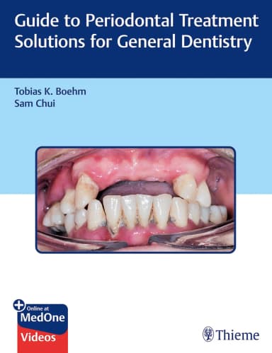 Image of - Guide to Periodontal Treatment Solutions for General Dentistry 1st Ed.
