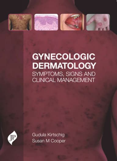 Image of - Gynecologic Dermatology