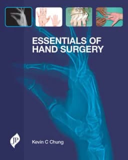 hand-surgery-essentials-1st-edition