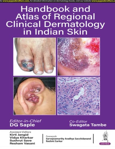 Image of - Handbook and Atlas of Regional Clinical Dermatology in Indian Skin