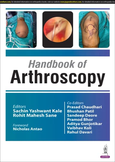 Image of - Handbook of Arthroscopy