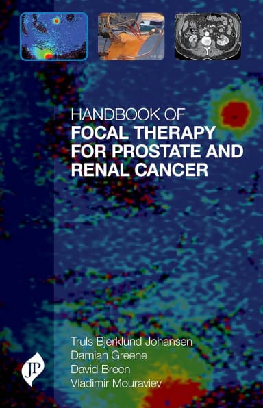 Image of - Handbook of Focal Therapy for Prostate and Renal Cancer - 1st Edition 2017