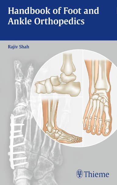 Image of - Handbook of Foot and Ankle Orthopedics