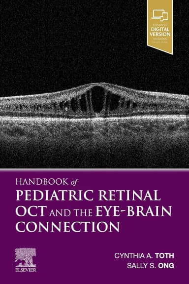 Image of - Handbook of Pediatric Retinal OCT and the Eye-Brain Connection-1E