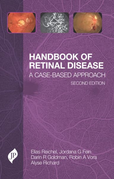 Image of - Handbook of Retinal Disease | A Case- Based Approach