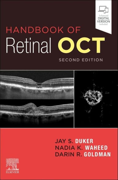 Image of - Handbook of Retinal OCT: Optical Coherence Tomography-2E