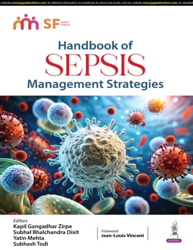 Image of - Handbook of SEPSIS | Management Strategies