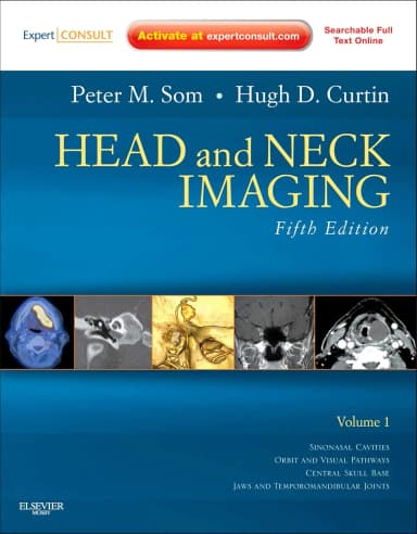 Image of - Head and Neck Imaging 5/e (2 Vols)
