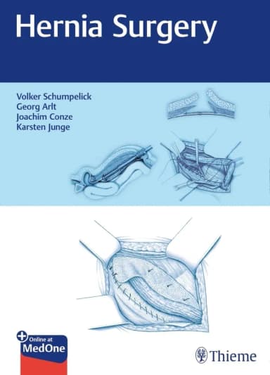 Image of - Hernia Surgery 1st Ed.