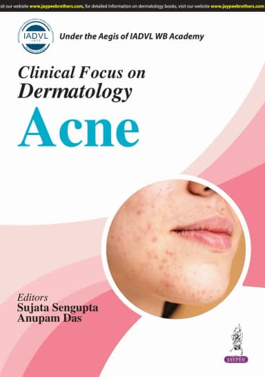 Image of - IADVL Clinical Focus on Dermatology Acne