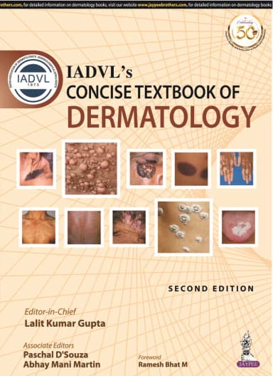 Image of - IADVLs Concise Textbook of Dermatology
