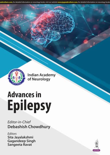 Image of - IAN Advances in Epilepsy