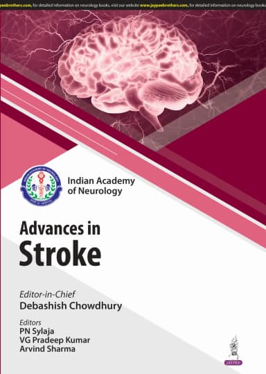 Image of - IAN Advances in Stroke