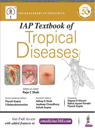 Image of - IAP Textbook of Tropical Diseases