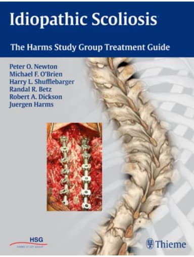 Image of - Idiopathic Scoliosis - 1st Edition
