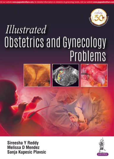 Image of - Illustrated Obstetrics and Gynecology Problems