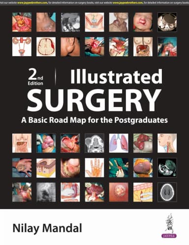 Image of - Illustrated Surgery | A Basic Road Map For The Postgraduates