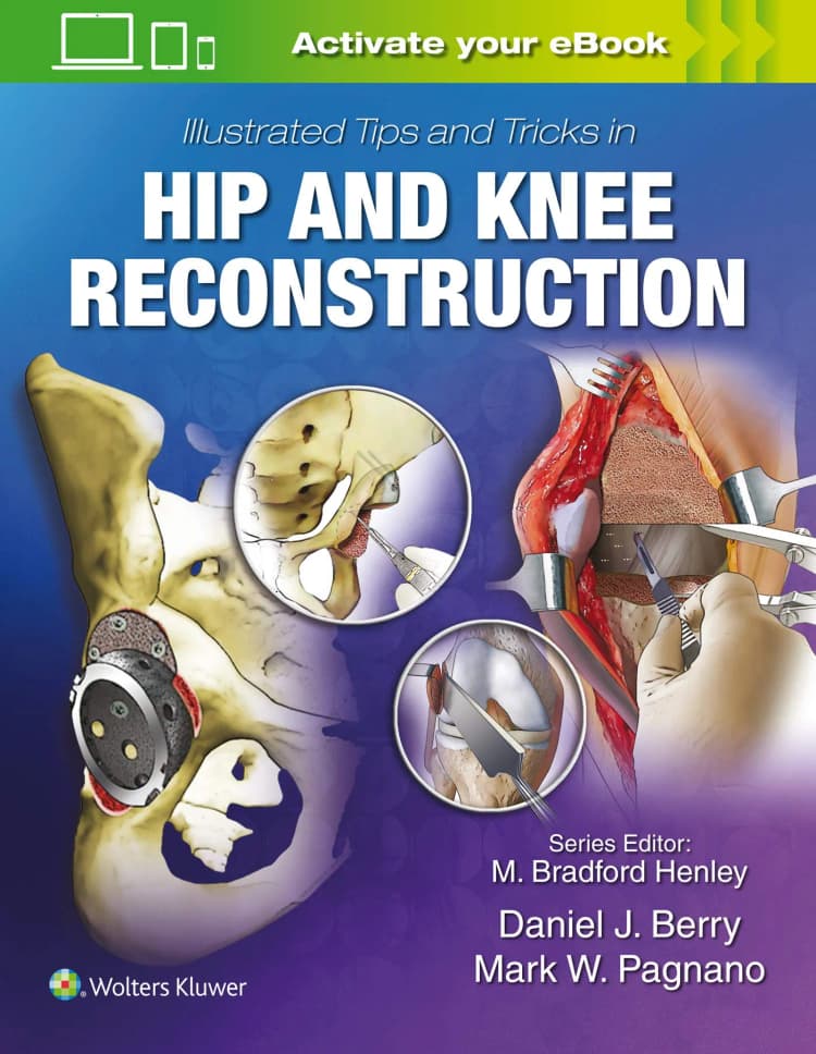 Illustrated Tips and Tricks in Hip and Knee Reconstructive and Replacement Surgery - 5th Edition