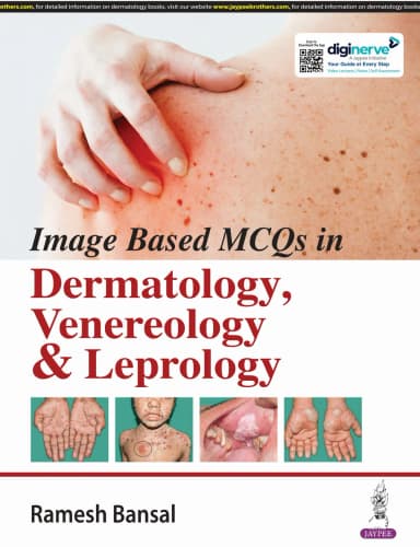 Image of - Image Based Mcqs in Dermatology, Venereology & Leprology