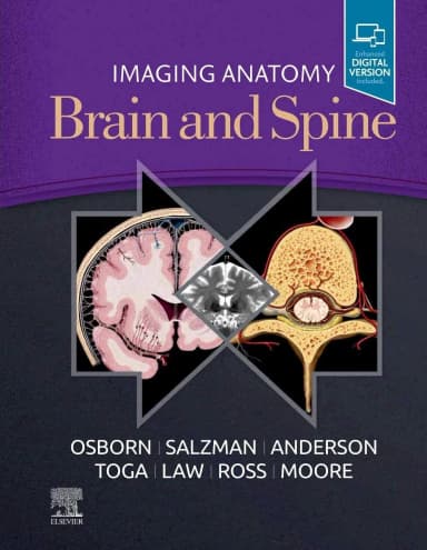 Image of - Imaging Anatomy Brain and Spine-1E